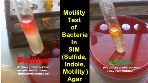 soft agar motility test|motile vs non bacteria.